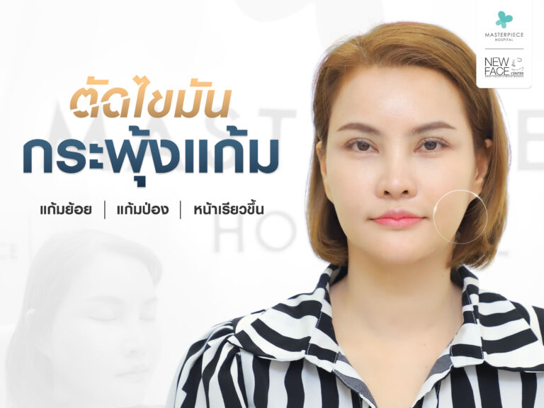 ตัดไขมันกระพุ้งแก้ม จบปัญหาแก้มย้อย แก้มป่อง หน้าเรียวขึ้น