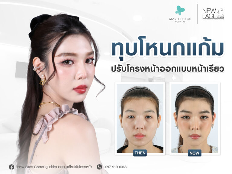ทุบโหนกแก้ม ปรับโครงหน้า ออกแบบหน้าเรียว สวยละมุน