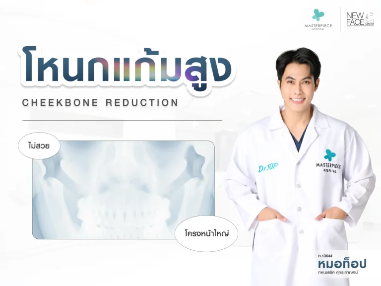 โหนกแก้มสูง โครงหน้าใหญ่ไม่สวย สาเหตุ วิธีแก้ ?