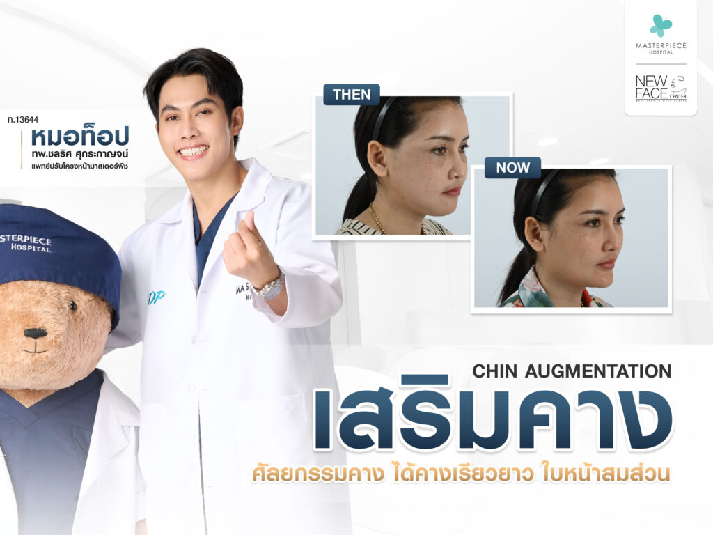 เสริมคาง ศัลยกรรมคาง ได้คางเรียวยาว ใบหน้าสมส่วน