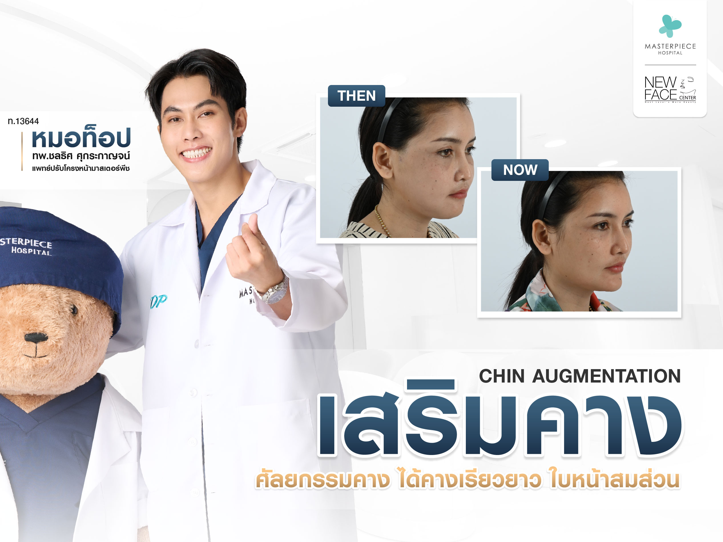 เสริมคาง ศัลยกรรมคาง ได้คางเรียวยาว ใบหน้าสมส่วน