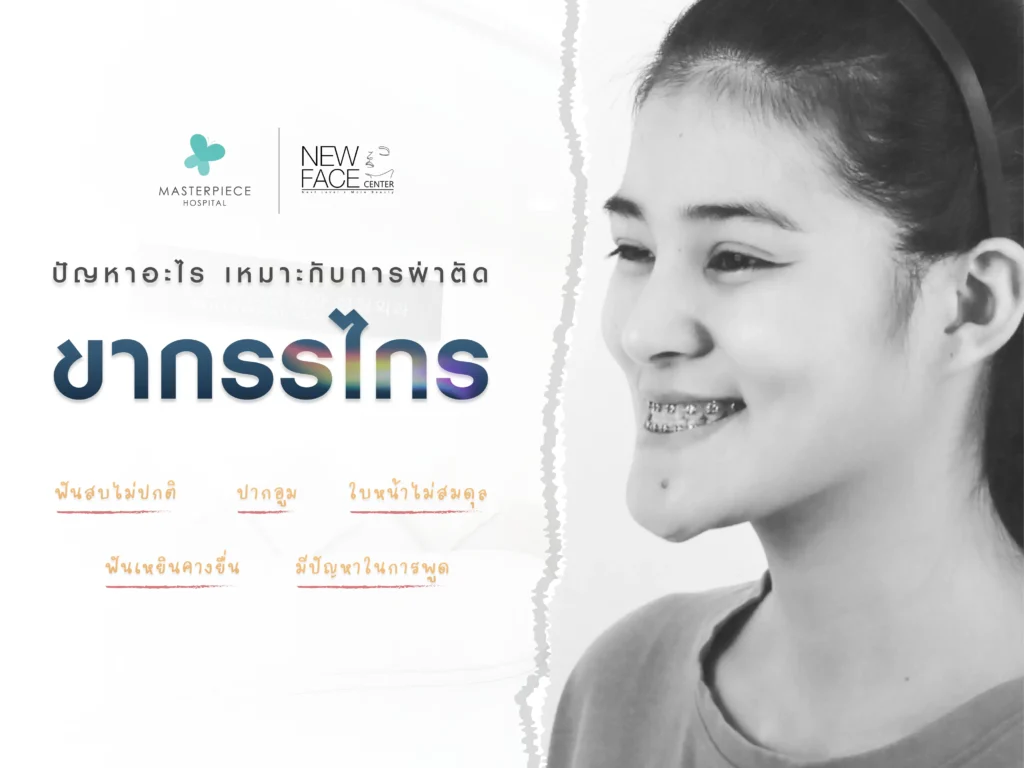 ปัญหาอะไร เหมาะสำหรับผ่าตัดเลื่อนขากรรไกร