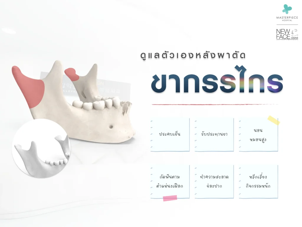 การดูแลตัวเองหลังผ่าตัดขากรรไกร