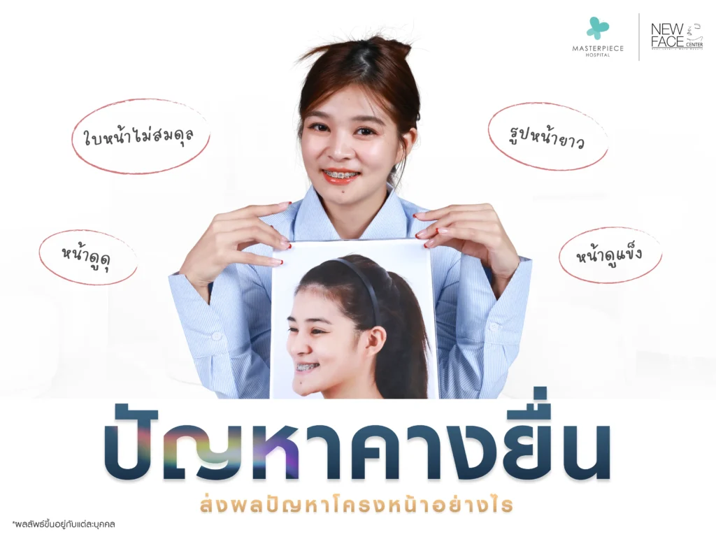 ปัญหาคางยื่น ส่งผลปัญหาโครงหน้าอย่างไร