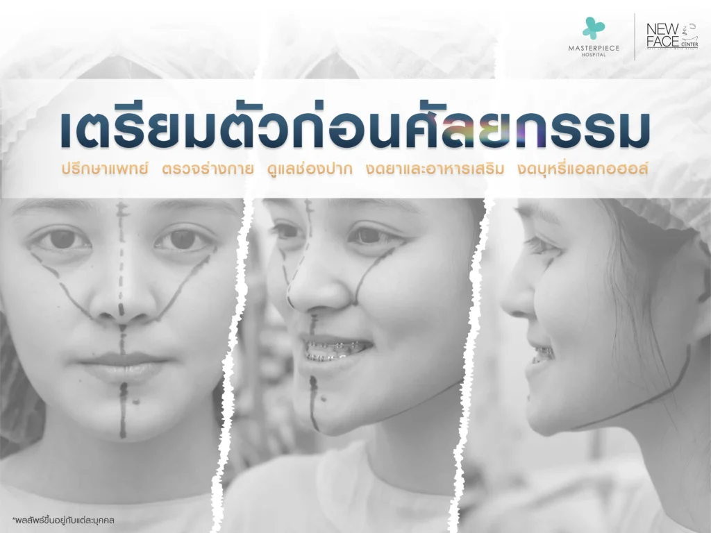 การเตรียมตัวก่อนเข้าศัลยกรรมผ่าตัดแก้ไขคางยื่น