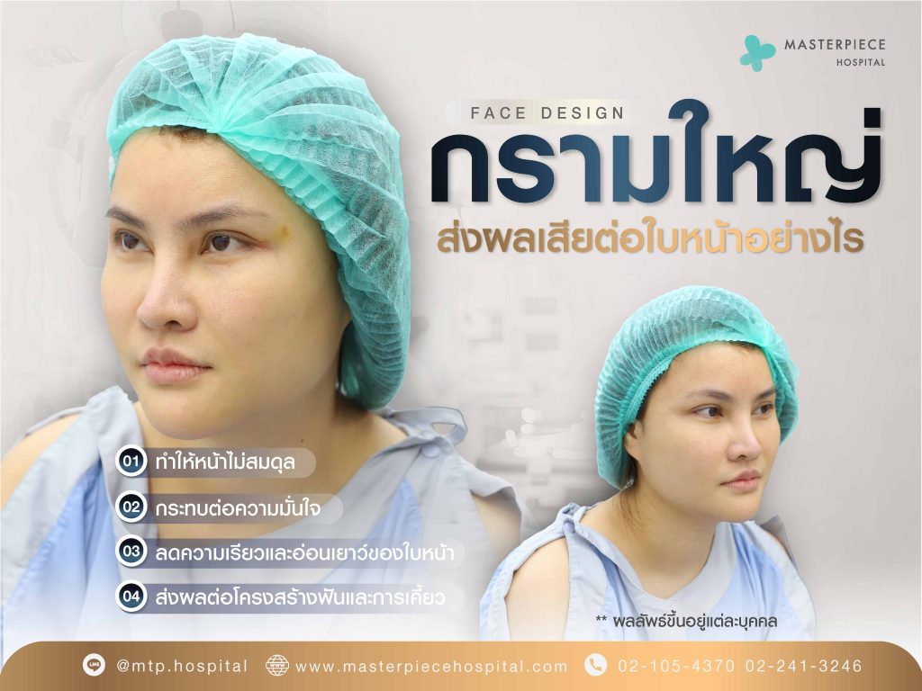 กรามใหญ่ ส่งผลเสียต่อใบหน้าอย่างไร