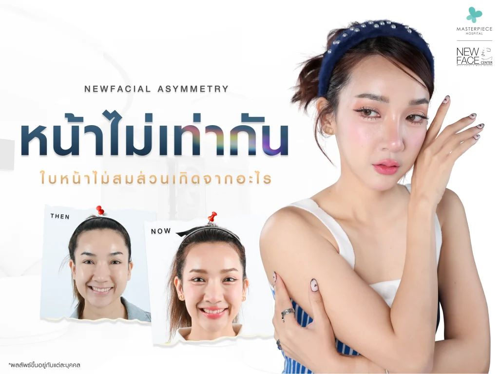 หน้าไม่เท่ากัน ใบหน้าไม่สมส่วน เกิดจากอะไร วิธีแก้ไข