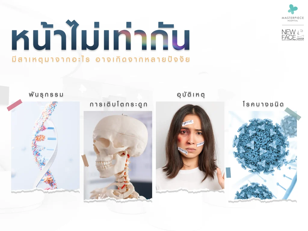หน้าไม่เท่ากัน มีสาเหตุมาจากอะไร