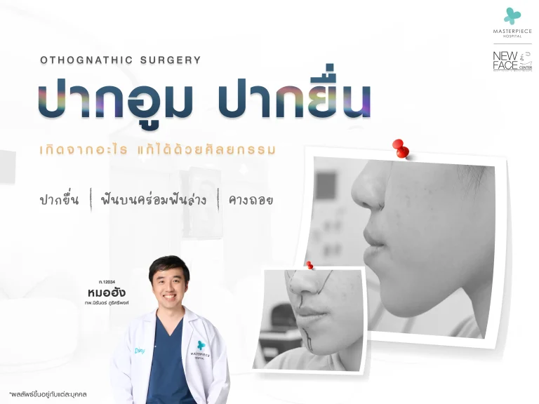 ปากอูม ปากยื่น เกิดจากอะไร แก้ได้ด้วยศัลยกรรม ?