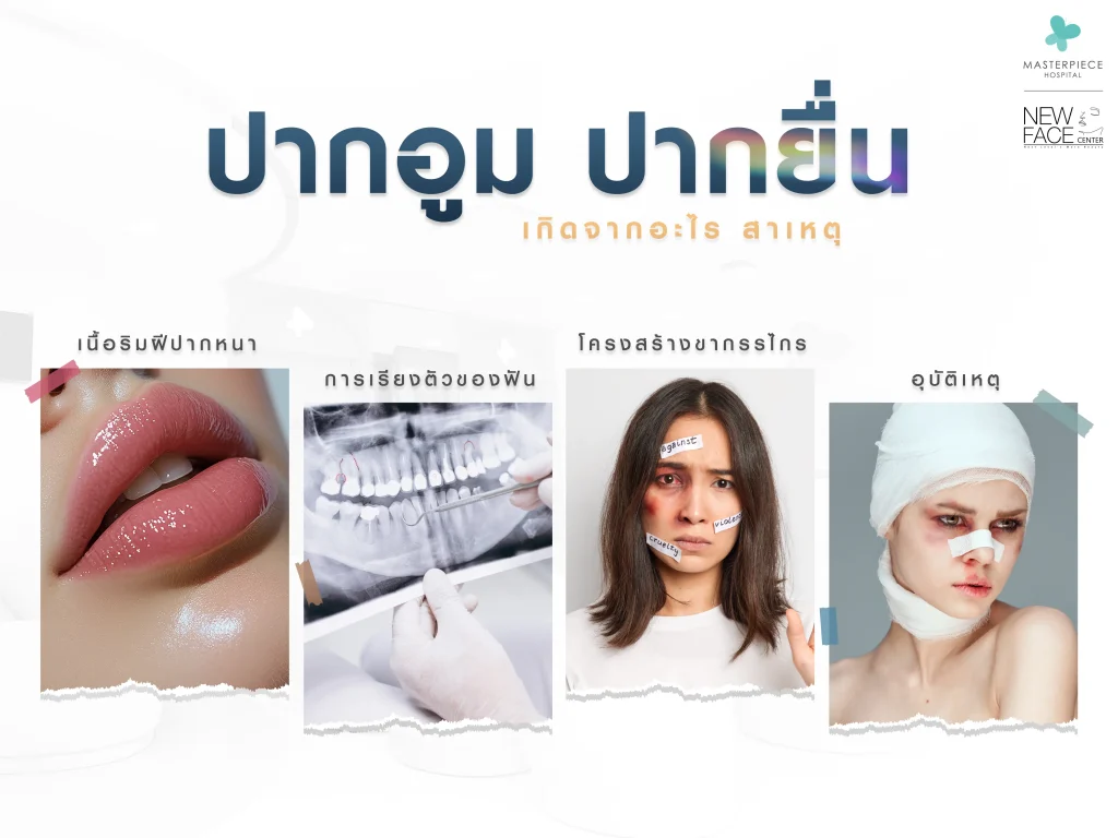 ปากอูม ปากยื่น เกิดจากอะไร สาเหตุ