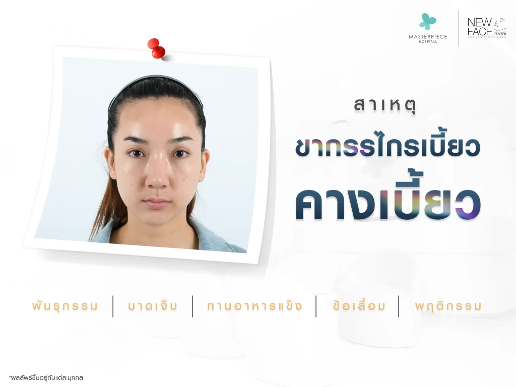 สาเหตุ ขากรรไกรเบี้ยว คางเบี้ยว เกิดจากอะไร