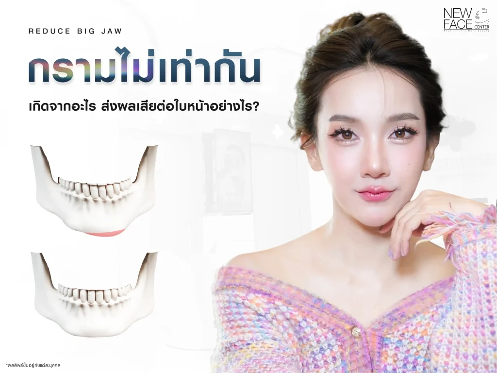 กรามไม่เท่ากัน เกิดจากอะไร ส่งผลเสียต่อใบหน้าอย่างไร ?