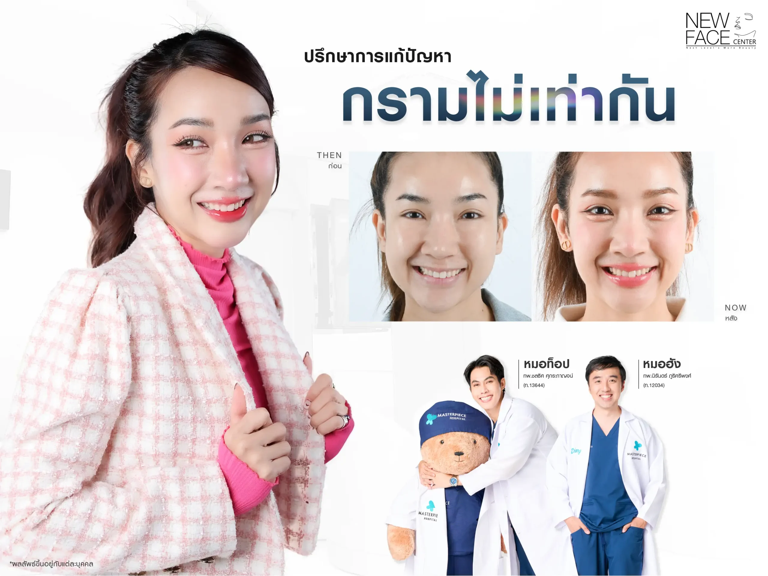 ปรึกษาการแก้ปัญหา กรามไม่เท่ากัน ทีมแพทย์โรงพยาบาลมาสเตอร์พีช ?
